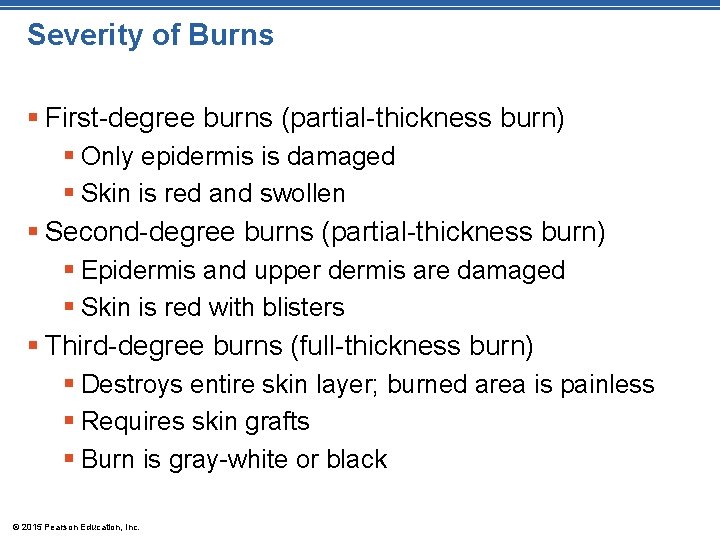 Severity of Burns § First-degree burns (partial-thickness burn) § Only epidermis is damaged §