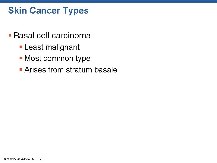 Skin Cancer Types § Basal cell carcinoma § Least malignant § Most common type