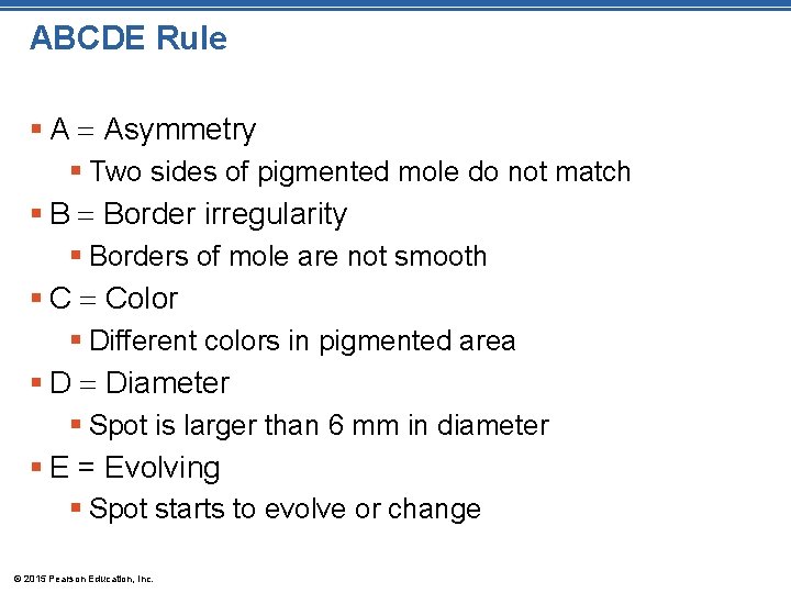 ABCDE Rule § A Asymmetry § Two sides of pigmented mole do not match