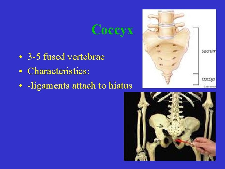 Coccyx • 3 -5 fused vertebrae • Characteristics: • -ligaments attach to hiatus 