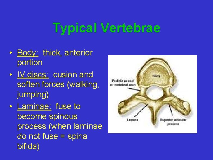 Typical Vertebrae • Body: thick, anterior portion • IV discs: cusion and soften forces
