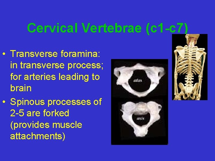 Cervical Vertebrae (c 1 -c 7) • Transverse foramina: in transverse process; for arteries