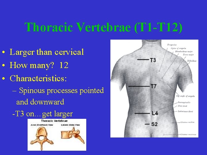 Thoracic Vertebrae (T 1 -T 12) • Larger than cervical • How many? 12