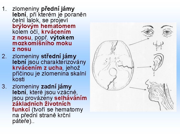 1. zlomeniny přední jámy lební, při kterém je poraněn čelní lalok, se projeví brýlovým