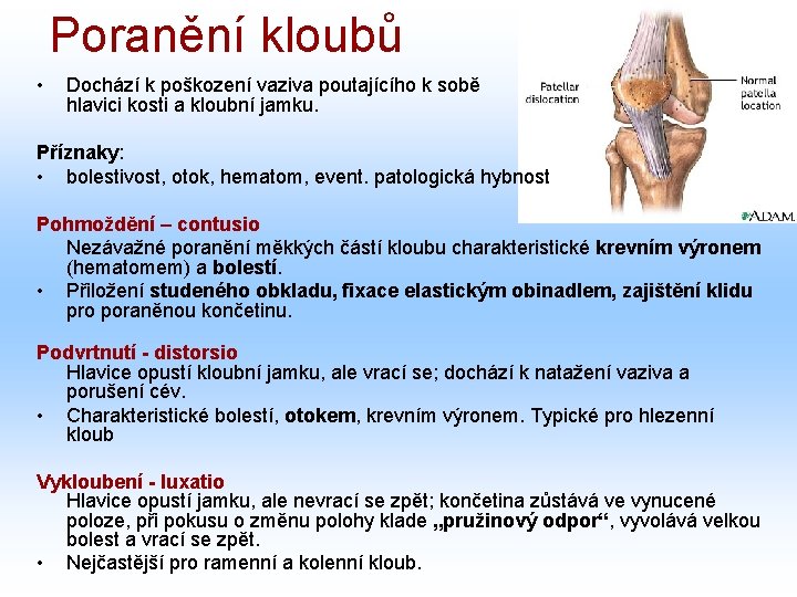 Poranění kloubů • Dochází k poškození vaziva poutajícího k sobě hlavici kosti a kloubní