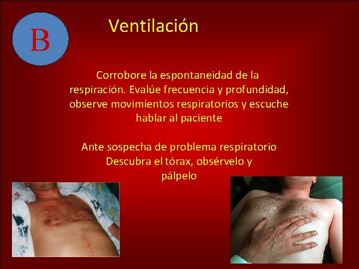 B Ventilación Corrobore la espontaneidad de la respiración. Evalúe frecuencia y profundidad, observe movimientos