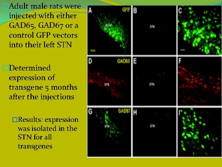 �Adult male rats were injected with either GAD 65, GAD 67 or a control