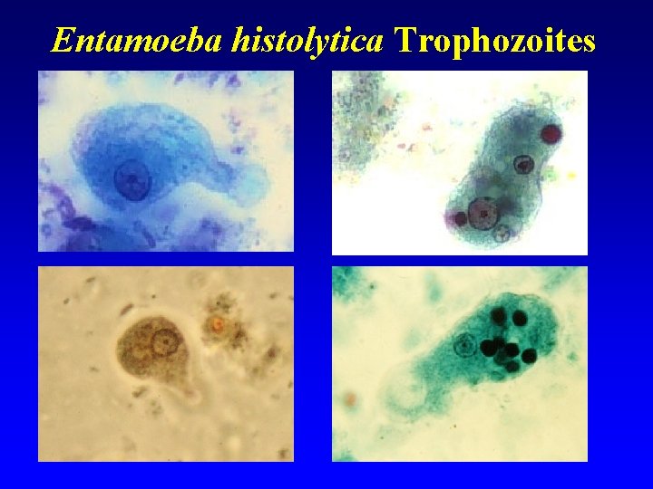 Entamoeba histolytica Trophozoites 