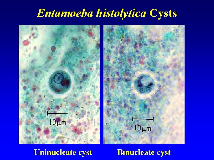 Entamoeba histolytica Cysts Uninucleate cyst Binucleate cyst 