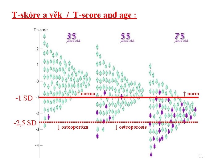 T-skóre a věk / T-score and age : -1 SD -2, 5 SD ↑
