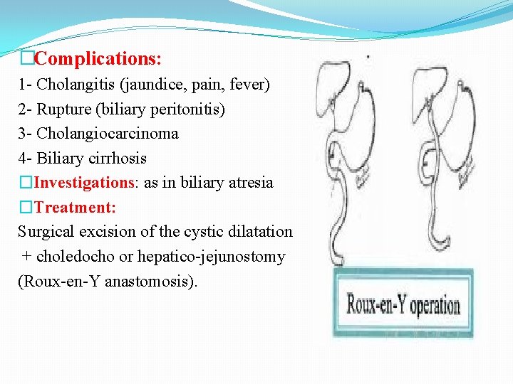 �Complications: 1 - Cholangitis (jaundice, pain, fever) 2 - Rupture (biliary peritonitis) 3 -