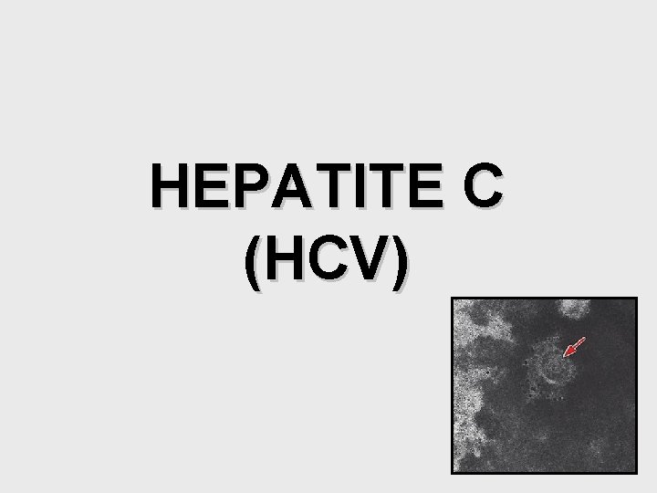 HEPATITE C (HCV) 