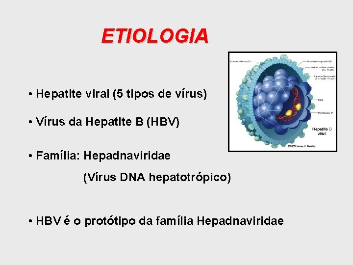 ETIOLOGIA • Hepatite viral (5 tipos de vírus) • Vírus da Hepatite B (HBV)