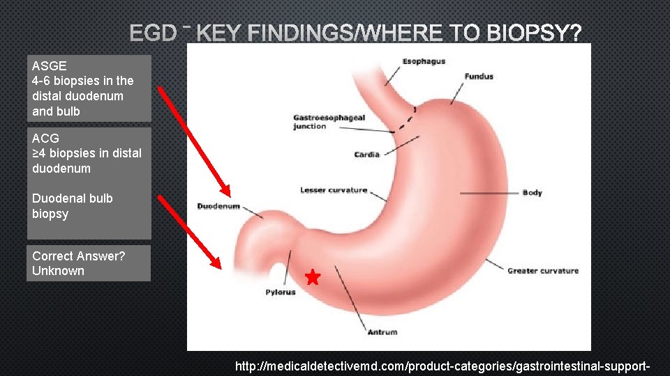EGD – KEY FINDINGS/WHERE TO BIOPSY? ASGE 4 -6 biopsies in the distal duodenum