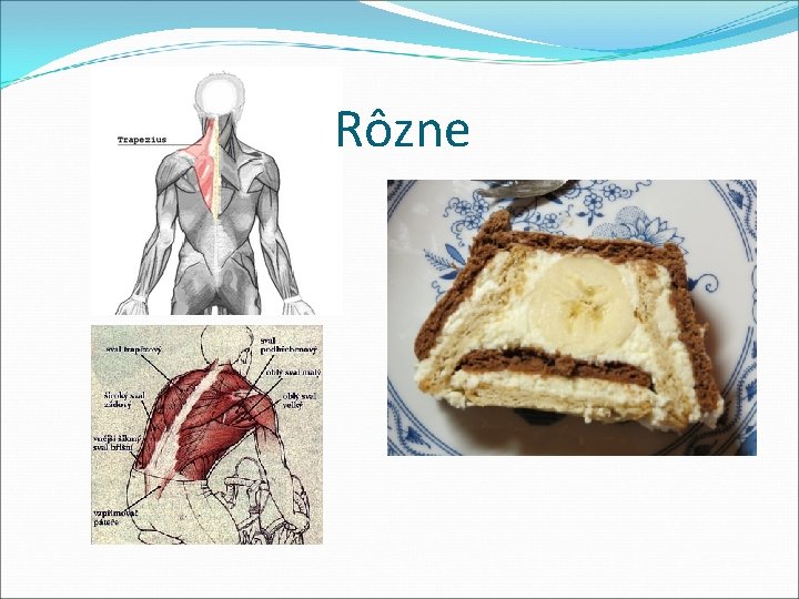 Rôzne Rôzne