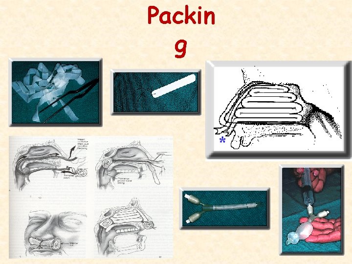 Packin g 