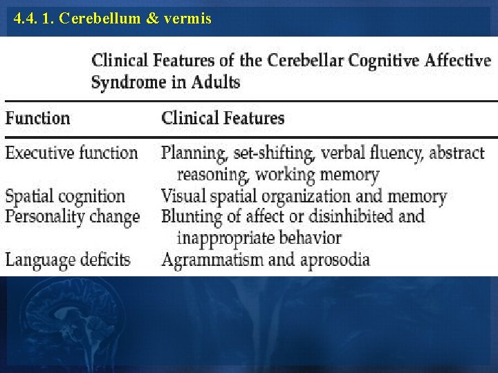 4. 4. 1. Cerebellum & vermis 4. 4. 1. Cerebellum & vermis