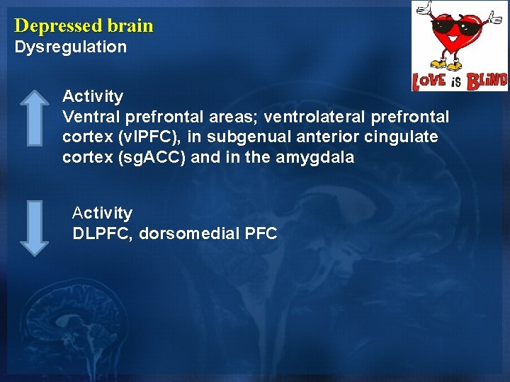 Depressed brain Dysregulation Activity Ventral prefrontal areas; ventrolateral prefrontal cortex (vl. PFC), in subgenual Depressed brain Dysregulation Activity Ventral prefrontal areas; ventrolateral prefrontal cortex (vl. PFC), in subgenual