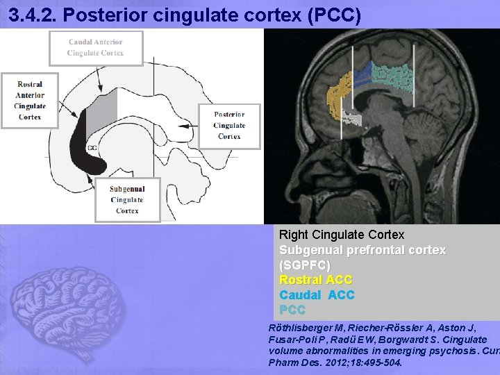 3. 4. 2. Posterior cingulate cortex (PCC) Right Cingulate Cortex Subgenual prefrontal cortex (SGPFC)