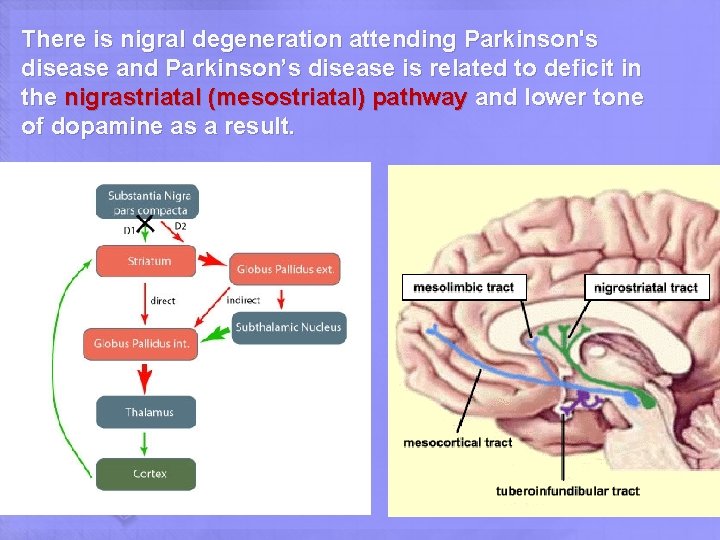 There is nigral degeneration attending Parkinson's disease and Parkinson’s disease is related to deficit There is nigral degeneration attending Parkinson's disease and Parkinson’s disease is related to deficit