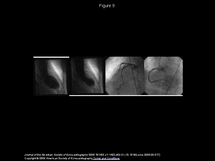 Figure 9 Journal of the American Society of Echocardiography 2005 181423. e 1 -1423.