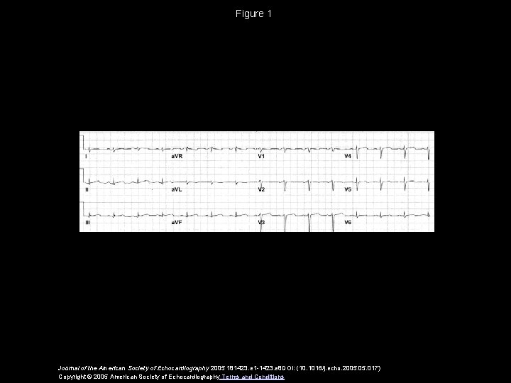 Figure 1 Journal of the American Society of Echocardiography 2005 181423. e 1 -1423.