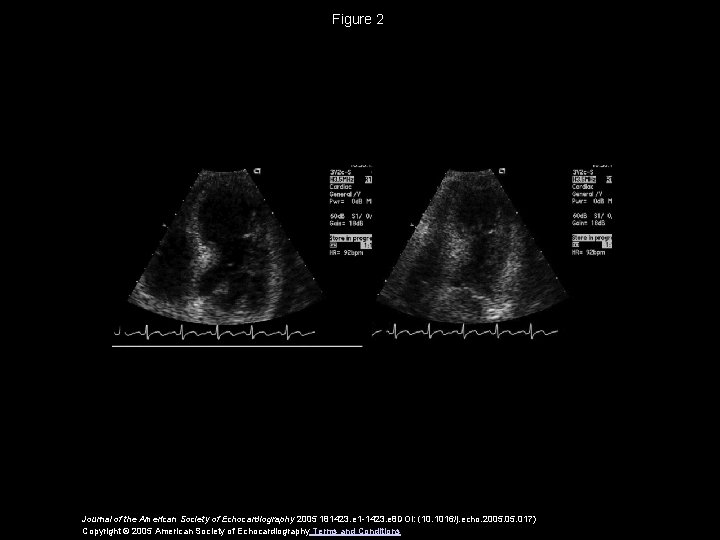 Figure 2 Journal of the American Society of Echocardiography 2005 181423. e 1 -1423.