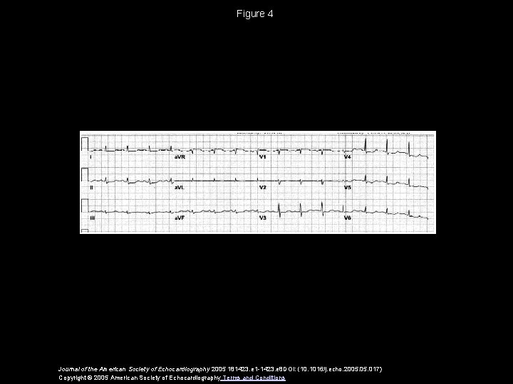 Figure 4 Journal of the American Society of Echocardiography 2005 181423. e 1 -1423.