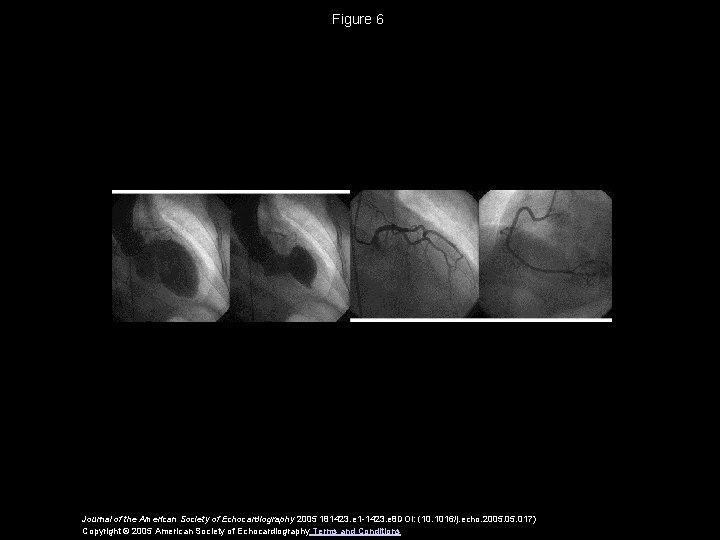 Figure 6 Journal of the American Society of Echocardiography 2005 181423. e 1 -1423.