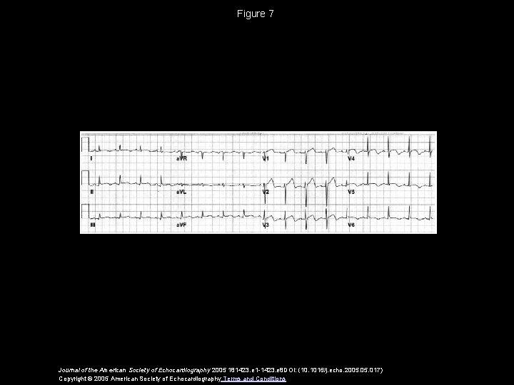 Figure 7 Journal of the American Society of Echocardiography 2005 181423. e 1 -1423.