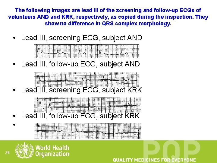 The following images are lead III of the screening and follow-up ECGs of volunteers