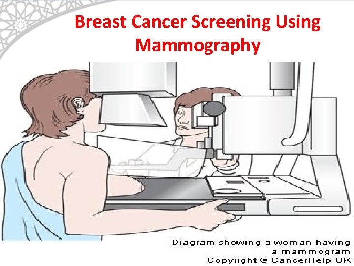 Breast Cancer Screening Using Mammography 