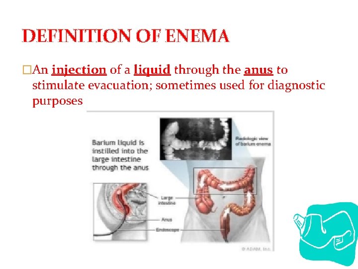 DEFINITION OF ENEMA �An injection of a liquid through the anus to stimulate evacuation;