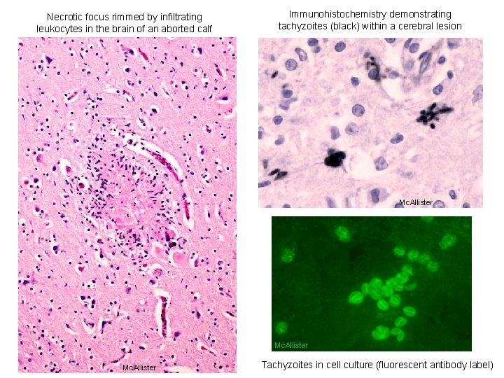 Necrotic focus rimmed by infiltrating leukocytes in the brain of an aborted calf Immunohistochemistry