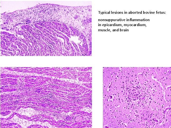 Typical lesions in aborted bovine fetus: nonsuppurative inflammation in epicardium, myocardium, muscle, and brain