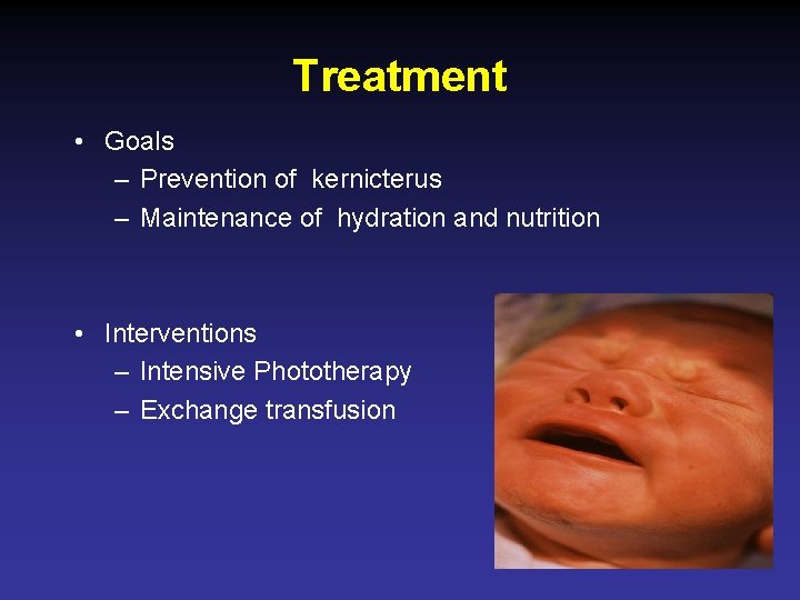 Treatment • Goals – Prevention of kernicterus – Maintenance of hydration and nutrition •