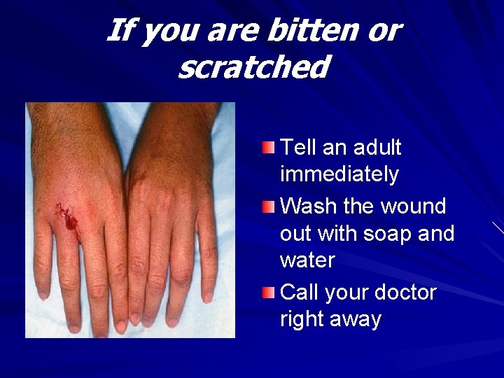 If you are bitten or scratched Tell an adult immediately Wash the wound out