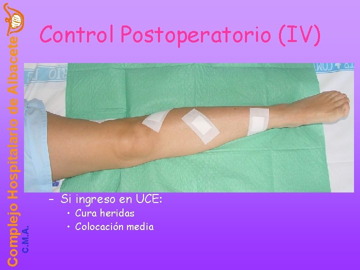 C. M. A. Complejo Hospitalario de Albacete Control Postoperatorio (IV) • 3ª Etapa o