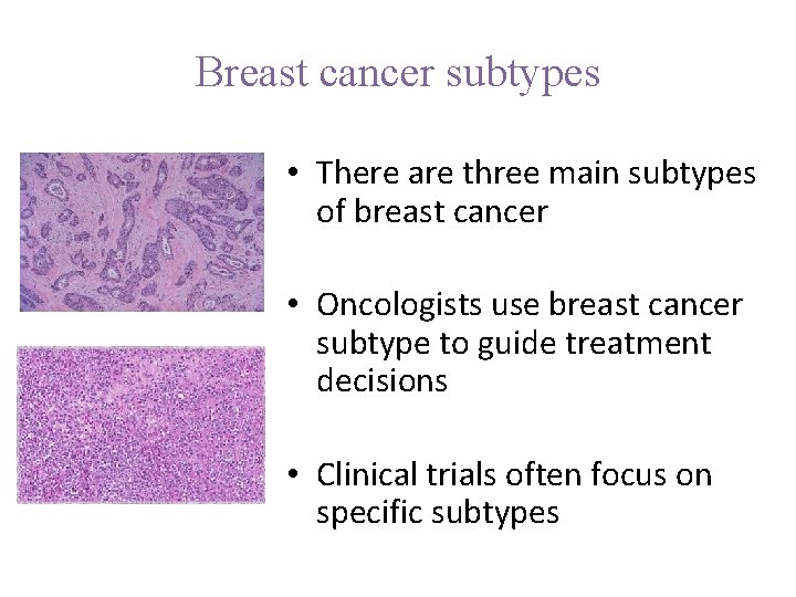 Breast cancer subtypes • There are three main subtypes of breast cancer • Oncologists