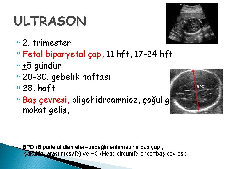 ULTRASON 2. trimester Fetal biparyetal çap, 11 hft, 17 -24 hft +5 gündür 20