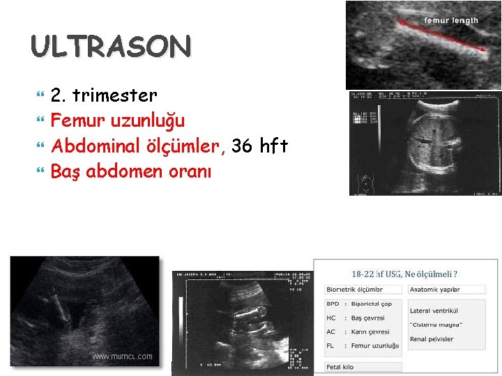 ULTRASON 2. trimester Femur uzunluğu Abdominal ölçümler, 36 hft Baş abdomen oranı 