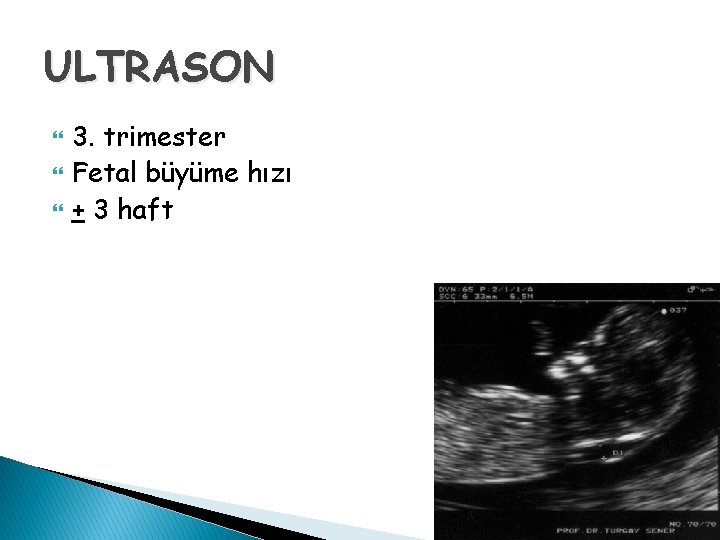 ULTRASON 3. trimester Fetal büyüme hızı + 3 haft 
