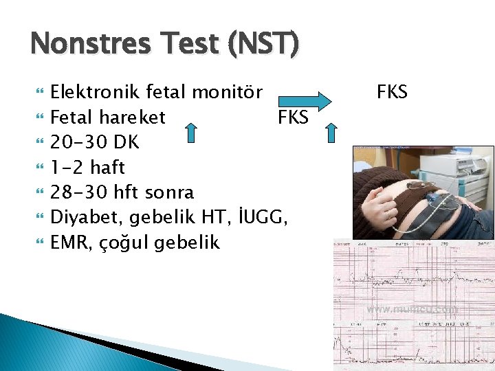 Nonstres Test (NST) Elektronik fetal monitör Fetal hareket FKS 20 -30 DK 1 -2