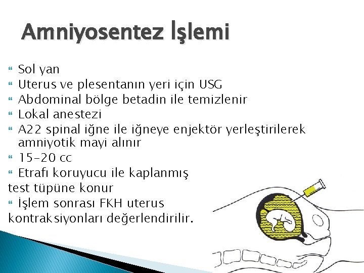 Amniyosentez İşlemi Sol yan Uterus ve plesentanın yeri için USG Abdominal bölge betadin ile