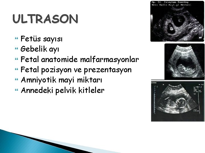 ULTRASON Fetüs sayısı Gebelik ayı Fetal anatomide malfarmasyonlar Fetal pozisyon ve prezentasyon Amniyotik mayi