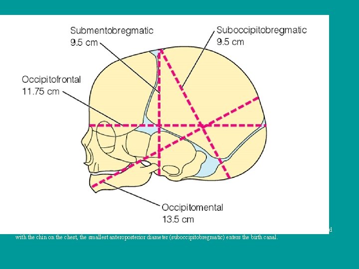 Figure 15– 4 a Typical anteroposterior diameters of the fetal skull. When the vertex