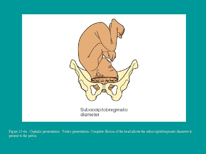 Figure 15– 6 a Cephalic presentation. Vertex presentation. Complete flexion of the head allows