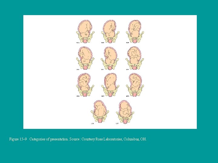 Figure 15– 9 Categories of presentation. Source: Courtesy Ross Laboratories, Columbus, OH. 