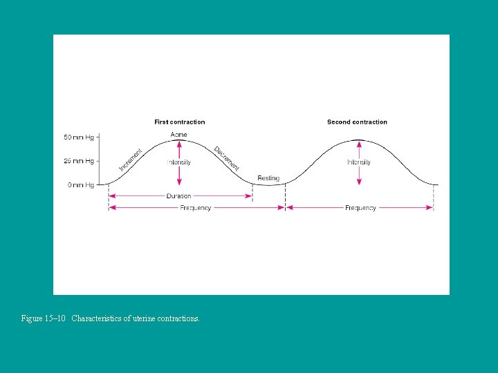 Figure 15– 10 Characteristics of uterine contractions. 