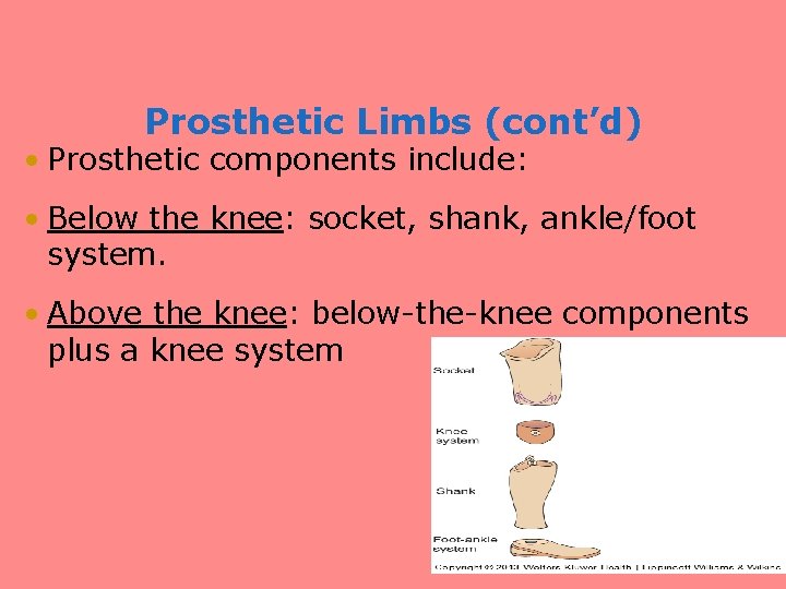 Prosthetic Limbs (cont’d) • Prosthetic components include: • Below the knee: socket, shank, ankle/foot